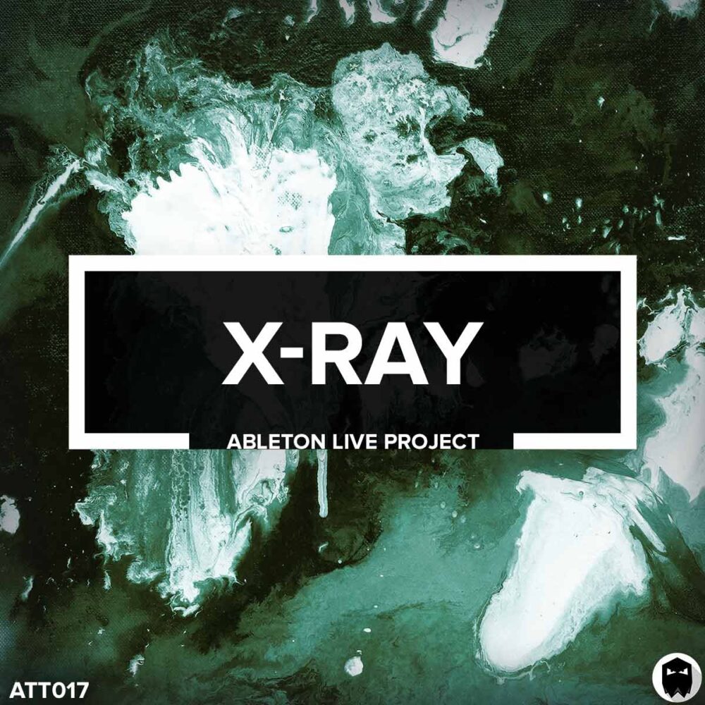 Audiotent X-Ray